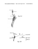 WAVEFORM SHAPES FOR TREATING NEUROLOGICAL DISORDERS OPTIMIZED FOR ENERGY     EFFICIENCY diagram and image