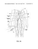 NEUROMODULATION CRYOTHERAPEUTIC DEVICES AND ASSOCIATED SYSTEMS AND METHODS diagram and image