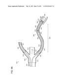 NEUROMODULATION CRYOTHERAPEUTIC DEVICES AND ASSOCIATED SYSTEMS AND METHODS diagram and image