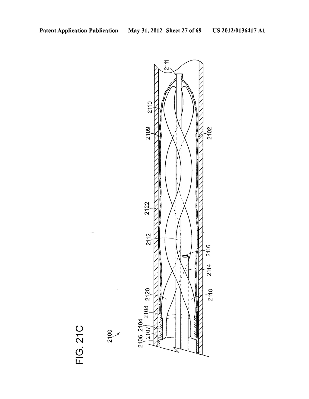 NEUROMODULATION CRYOTHERAPEUTIC DEVICES AND ASSOCIATED SYSTEMS AND METHODS - diagram, schematic, and image 28