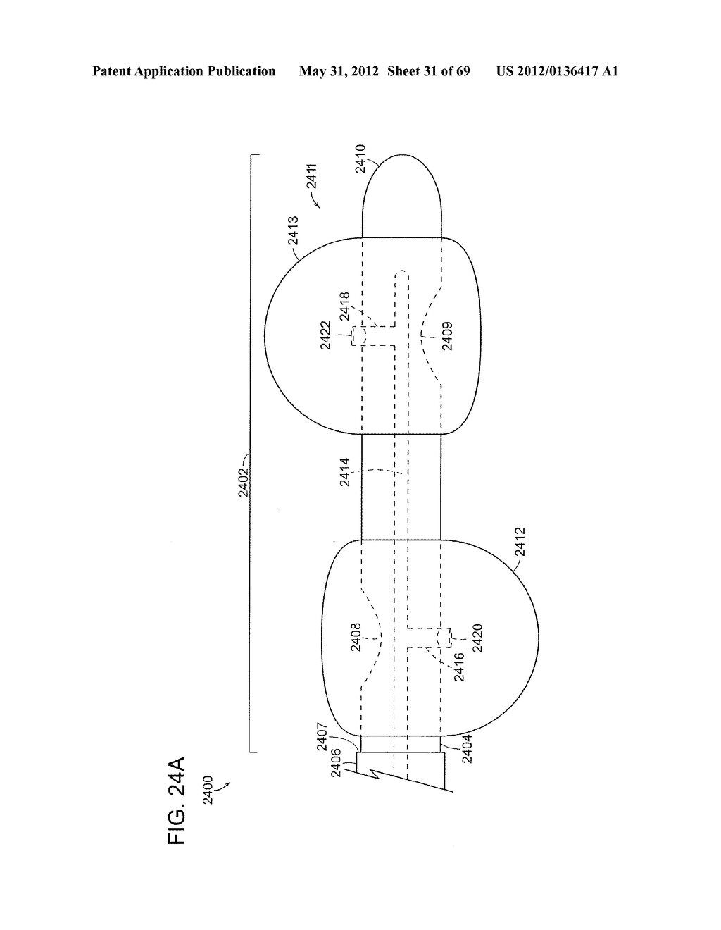 NEUROMODULATION CRYOTHERAPEUTIC DEVICES AND ASSOCIATED SYSTEMS AND METHODS - diagram, schematic, and image 32