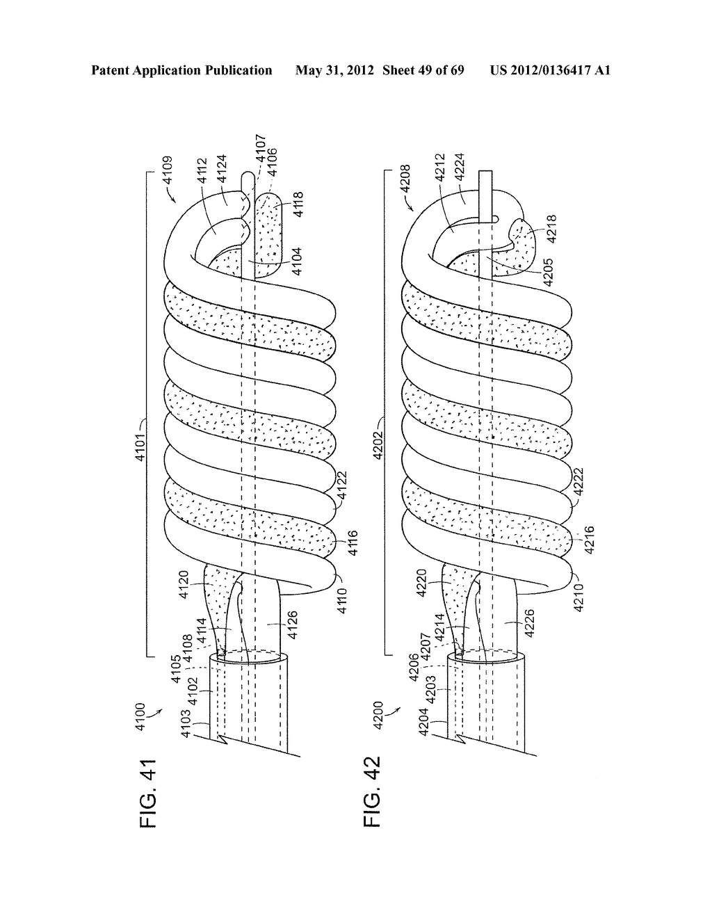 NEUROMODULATION CRYOTHERAPEUTIC DEVICES AND ASSOCIATED SYSTEMS AND METHODS - diagram, schematic, and image 50