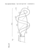 NEUROMODULATION CRYOTHERAPEUTIC DEVICES AND ASSOCIATED SYSTEMS AND METHODS diagram and image