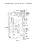 NEUROMODULATION CRYOTHERAPEUTIC DEVICES AND ASSOCIATED SYSTEMS AND METHODS diagram and image