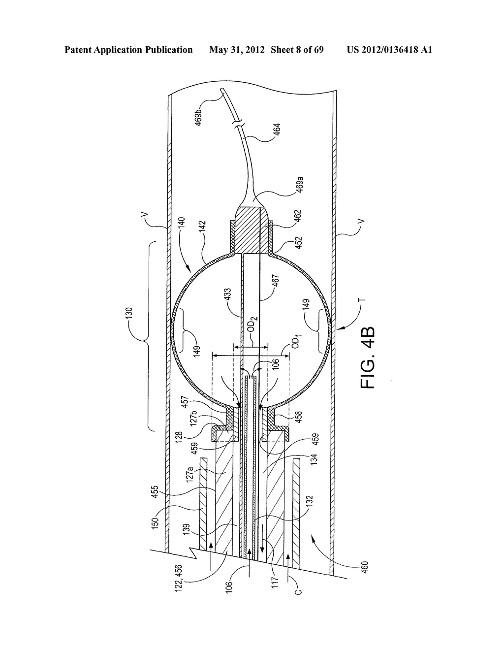 NEUROMODULATION CRYOTHERAPEUTIC DEVICES AND ASSOCIATED SYSTEMS AND METHODS - diagram, schematic, and image 09