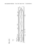 NEUROMODULATION CRYOTHERAPEUTIC DEVICES AND ASSOCIATED SYSTEMS AND METHODS diagram and image