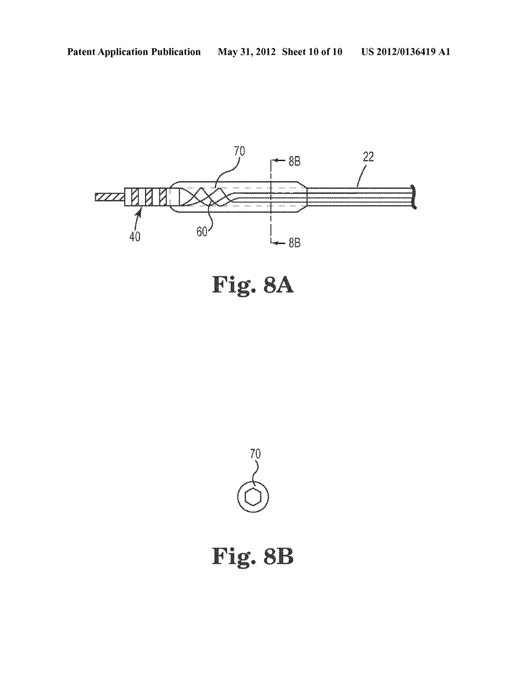 IMPLANTABLE MEDICAL LEADS WITH SPIRAL LUMENS - diagram, schematic, and image 11