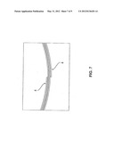 Medical Probe and a Method of Providing a Medical Probe diagram and image