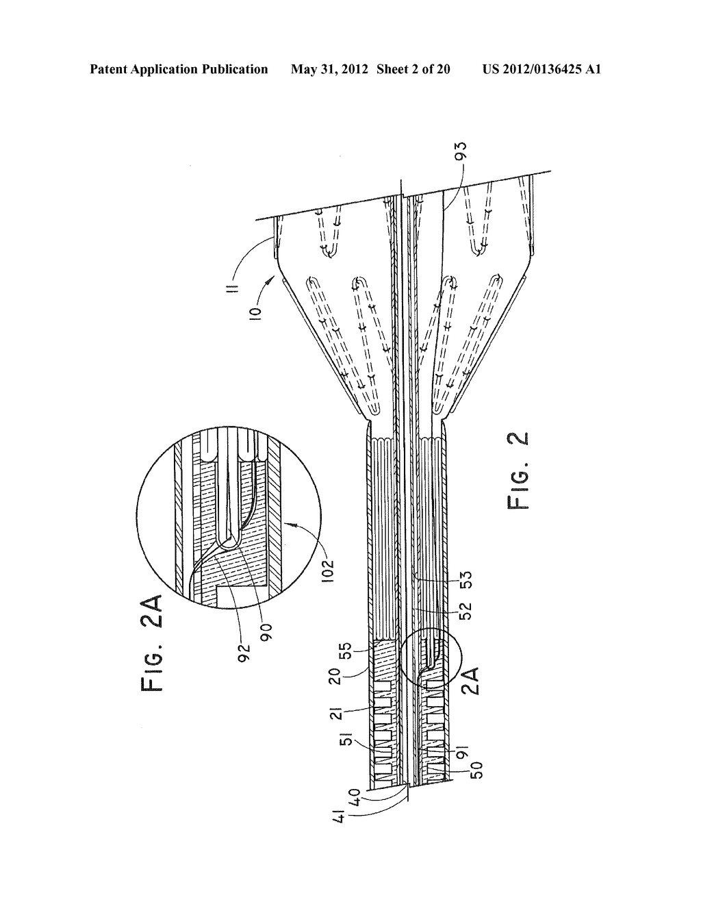 SLOTTED PUSHER ROD FOR FLEXIBLE DELIVERY SYSTEM - diagram, schematic, and image 03