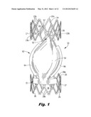 DEVICE FOR REGULATING BLOOD FLOW diagram and image