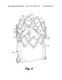 DEVICE FOR REGULATING BLOOD FLOW diagram and image