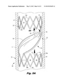 DEVICE FOR REGULATING BLOOD FLOW diagram and image