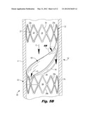 DEVICE FOR REGULATING BLOOD FLOW diagram and image