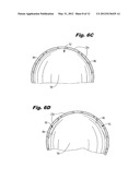 DEVICE FOR REGULATING BLOOD FLOW diagram and image