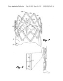 DEVICE FOR REGULATING BLOOD FLOW diagram and image