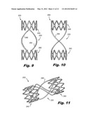 DEVICE FOR REGULATING BLOOD FLOW diagram and image