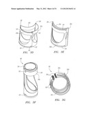 Prosthetic Heart Valves, Scaffolding Structures, and Systems and Methods     for Implantation of Same diagram and image