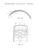 Prosthetic Heart Valves, Scaffolding Structures, and Systems and Methods     for Implantation of Same diagram and image