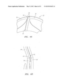 Prosthetic Heart Valves, Scaffolding Structures, and Systems and Methods     for Implantation of Same diagram and image