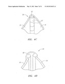 Prosthetic Heart Valves, Scaffolding Structures, and Systems and Methods     for Implantation of Same diagram and image