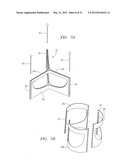 Prosthetic Heart Valves, Scaffolding Structures, and Systems and Methods     for Implantation of Same diagram and image