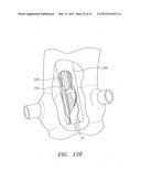 Prosthetic Heart Valves, Scaffolding Structures, and Systems and Methods     for Implantation of Same diagram and image