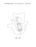 Prosthetic Heart Valves, Scaffolding Structures, and Systems and Methods     for Implantation of Same diagram and image