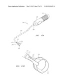 Prosthetic Heart Valves, Scaffolding Structures, and Systems and Methods     for Implantation of Same diagram and image