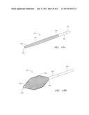 Prosthetic Heart Valves, Scaffolding Structures, and Systems and Methods     for Implantation of Same diagram and image