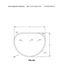 INTRAOPERATIVE AND POST-OPERATIVE ADJUSTMENT OF AN ANNULOPLASTY RING diagram and image