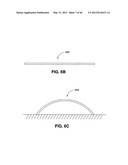 INTRAOPERATIVE AND POST-OPERATIVE ADJUSTMENT OF AN ANNULOPLASTY RING diagram and image