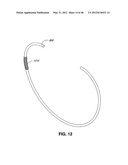 INTRAOPERATIVE AND POST-OPERATIVE ADJUSTMENT OF AN ANNULOPLASTY RING diagram and image