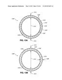 INTRAOPERATIVE AND POST-OPERATIVE ADJUSTMENT OF AN ANNULOPLASTY RING diagram and image
