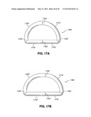 INTRAOPERATIVE AND POST-OPERATIVE ADJUSTMENT OF AN ANNULOPLASTY RING diagram and image