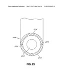 INTRAOPERATIVE AND POST-OPERATIVE ADJUSTMENT OF AN ANNULOPLASTY RING diagram and image