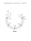 INTRAOPERATIVE AND POST-OPERATIVE ADJUSTMENT OF AN ANNULOPLASTY RING diagram and image