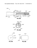 INTRAOPERATIVE AND POST-OPERATIVE ADJUSTMENT OF AN ANNULOPLASTY RING diagram and image