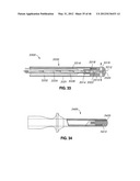 INTRAOPERATIVE AND POST-OPERATIVE ADJUSTMENT OF AN ANNULOPLASTY RING diagram and image