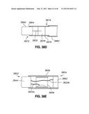 INTRAOPERATIVE AND POST-OPERATIVE ADJUSTMENT OF AN ANNULOPLASTY RING diagram and image