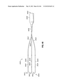 INTRAOPERATIVE AND POST-OPERATIVE ADJUSTMENT OF AN ANNULOPLASTY RING diagram and image