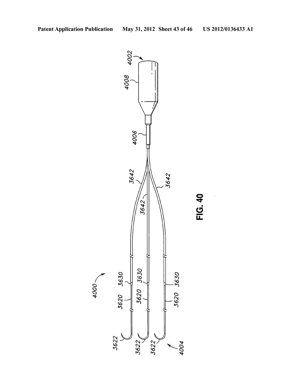 INTRAOPERATIVE AND POST-OPERATIVE ADJUSTMENT OF AN ANNULOPLASTY RING - diagram, schematic, and image 44