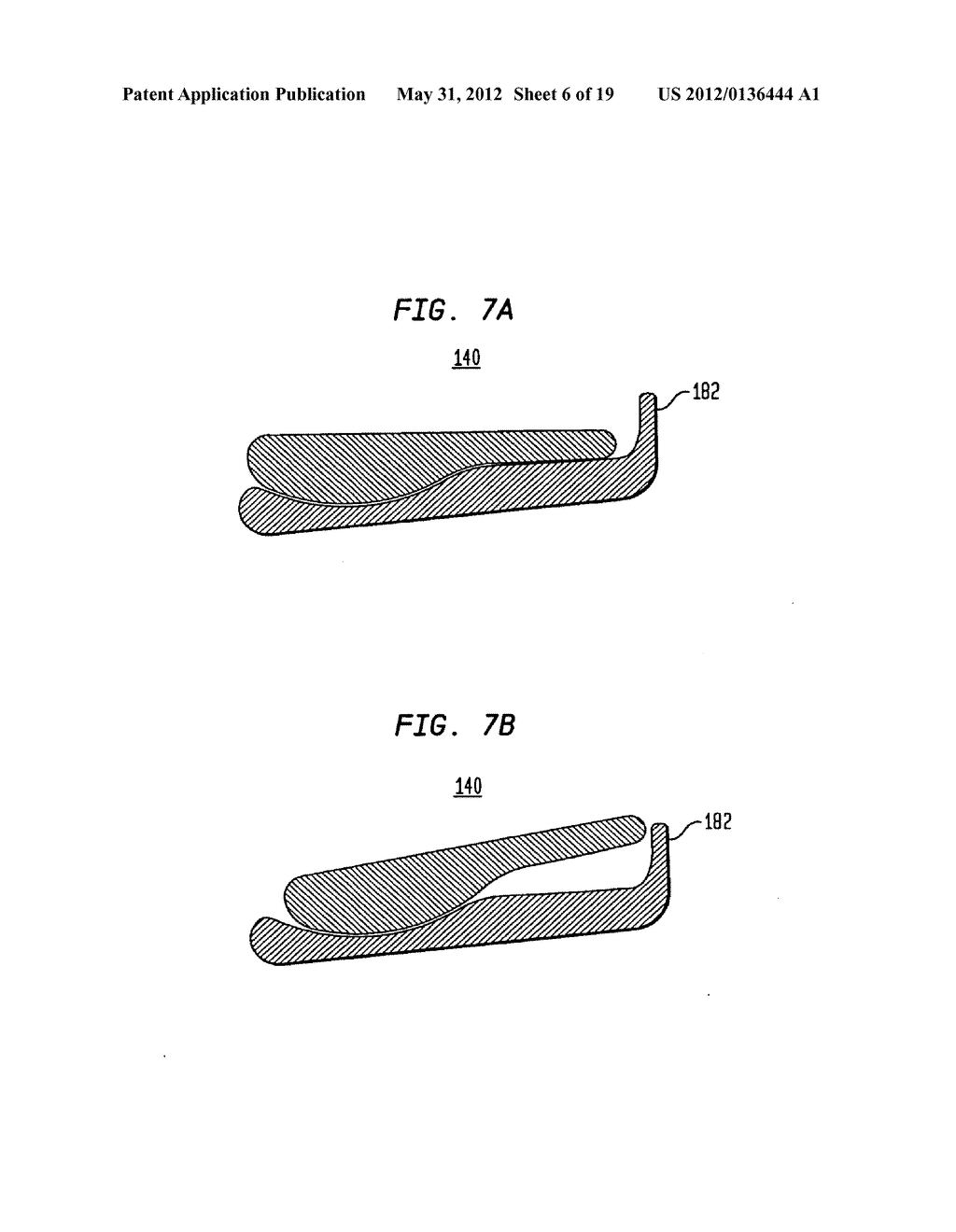 TWO-COMPONENT ARTIFICIAL DISC REPLACEMENTS - diagram, schematic, and image 07