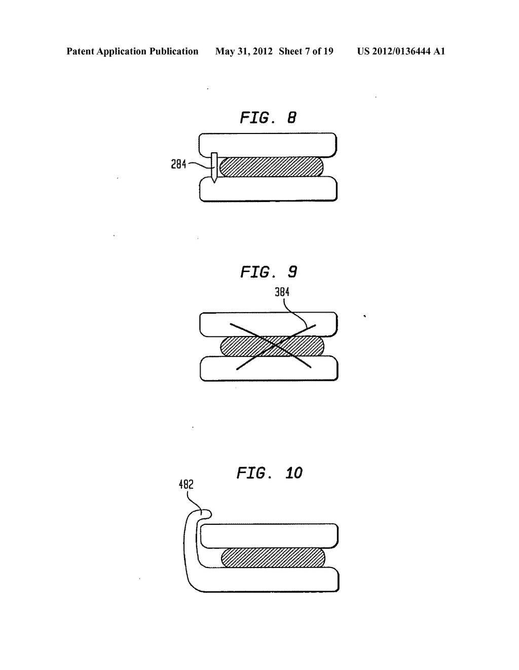 TWO-COMPONENT ARTIFICIAL DISC REPLACEMENTS - diagram, schematic, and image 08