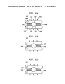 TWO-COMPONENT ARTIFICIAL DISC REPLACEMENTS diagram and image