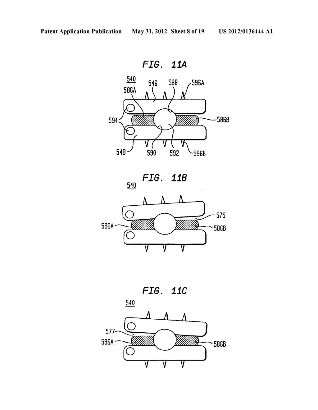 TWO-COMPONENT ARTIFICIAL DISC REPLACEMENTS - diagram, schematic, and image 09