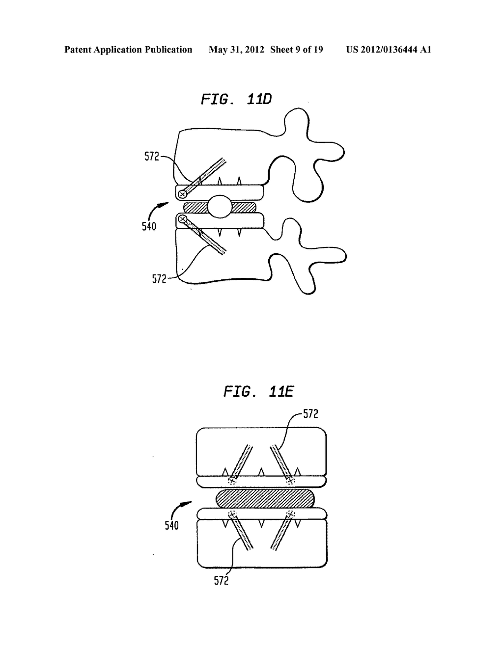 TWO-COMPONENT ARTIFICIAL DISC REPLACEMENTS - diagram, schematic, and image 10