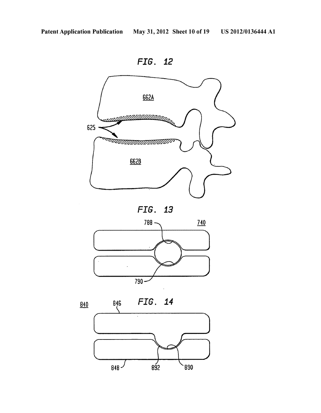 TWO-COMPONENT ARTIFICIAL DISC REPLACEMENTS - diagram, schematic, and image 11