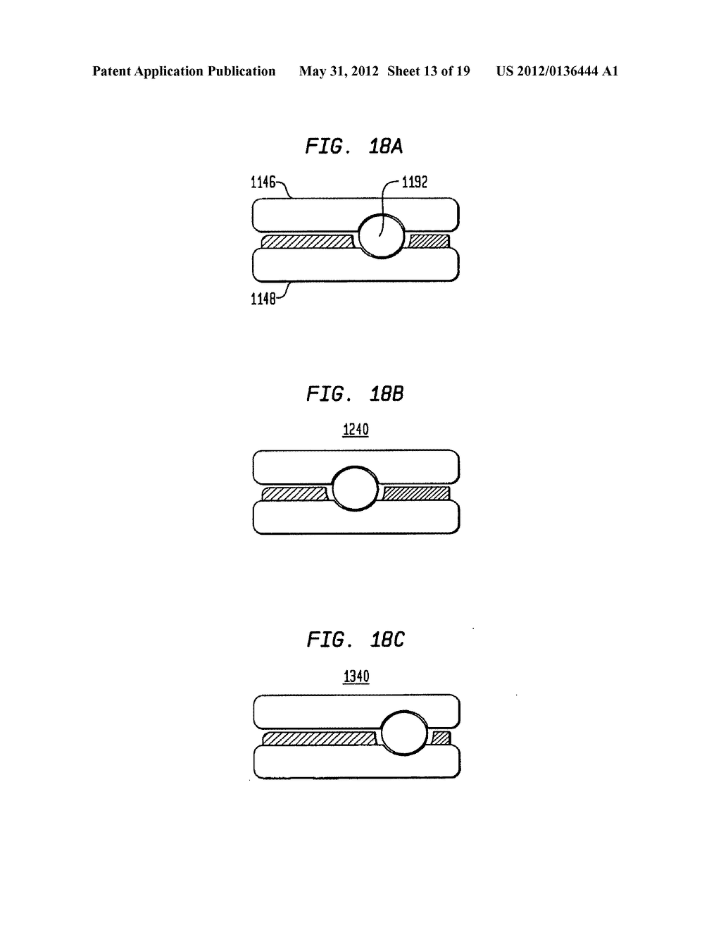 TWO-COMPONENT ARTIFICIAL DISC REPLACEMENTS - diagram, schematic, and image 14