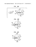 TWO-COMPONENT ARTIFICIAL DISC REPLACEMENTS diagram and image