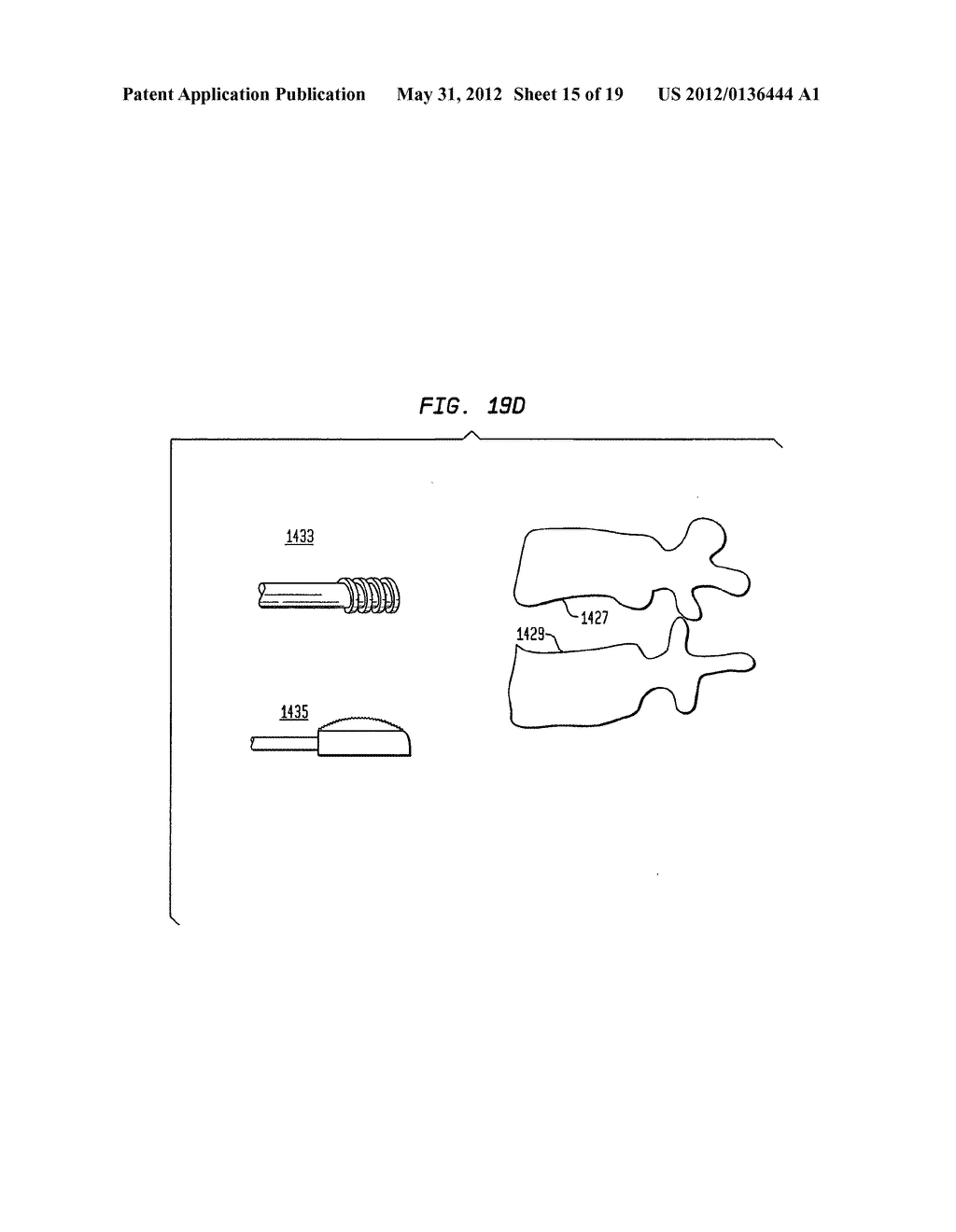 TWO-COMPONENT ARTIFICIAL DISC REPLACEMENTS - diagram, schematic, and image 16